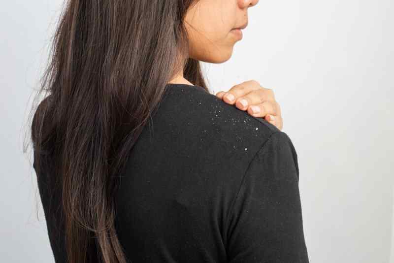 Best-Shampoo-for-Dry-Hair-and-Dandruff-in-India.jpg