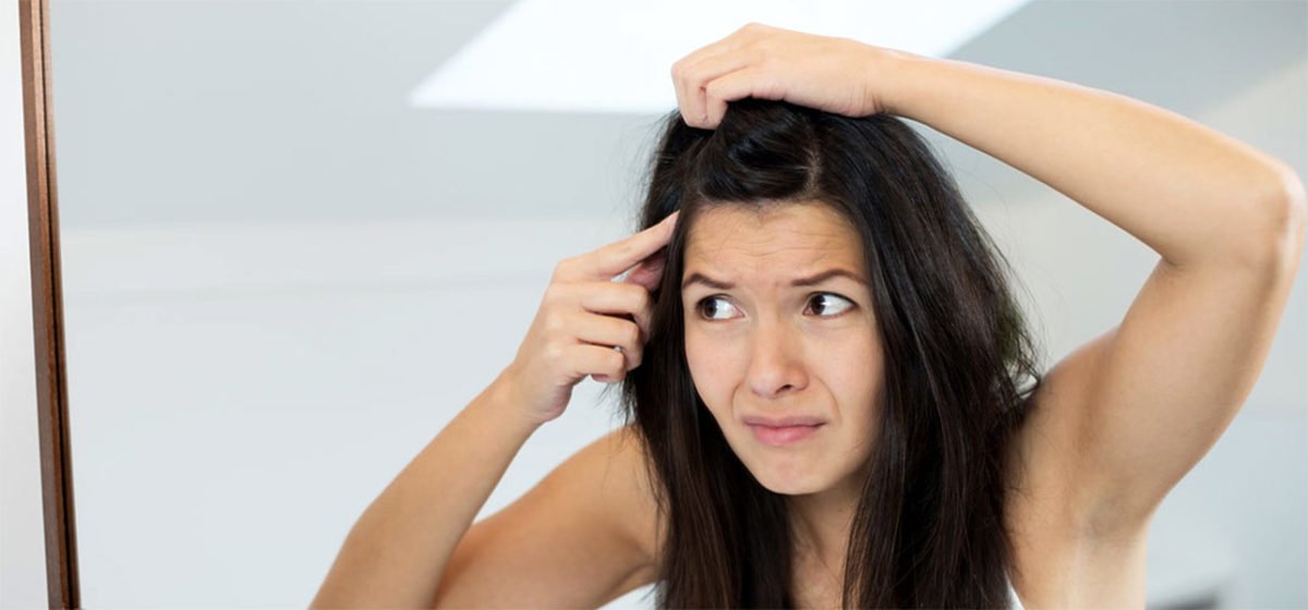 1255-Can-Dandruff-Cause-Hair-Loss-1200x560.jpg