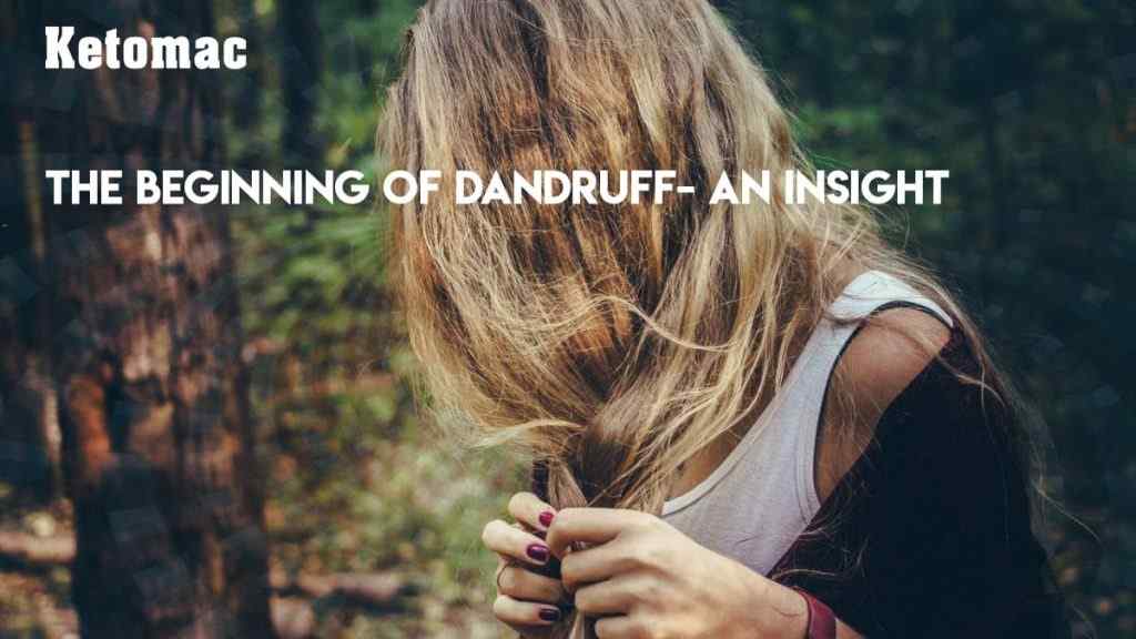 beginning stages of dandruff