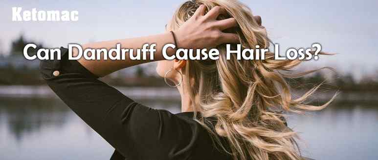 does dandruff cause hair loss