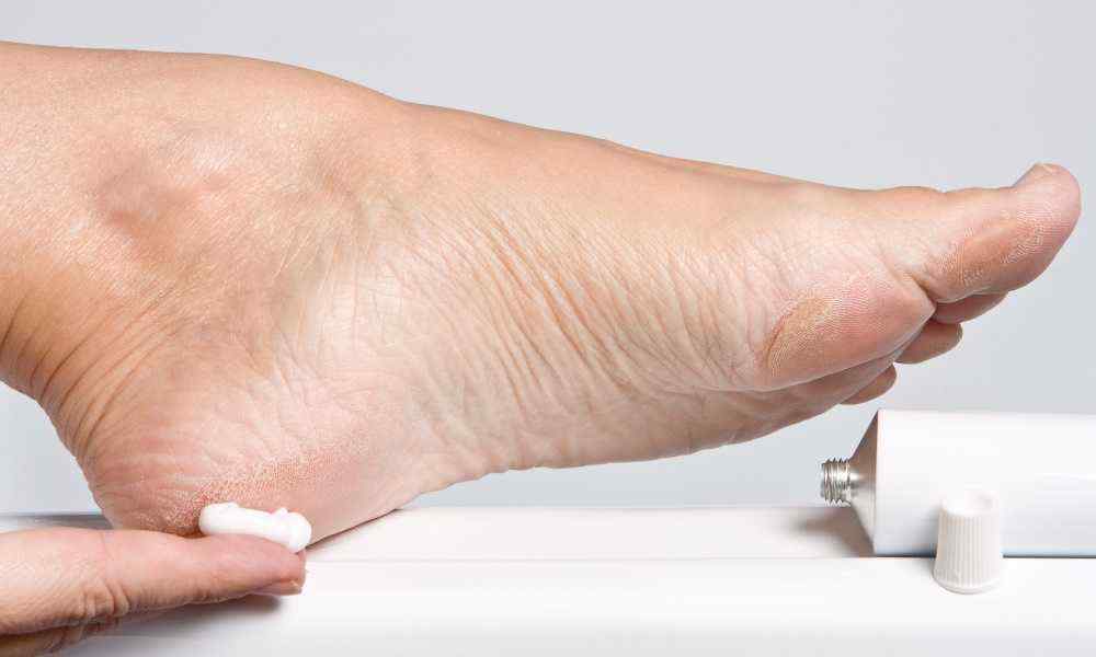 Does Antibiotic Cream Help Foot Fungus