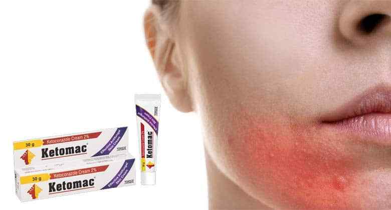 What Cream To Use For Fungal Skin Infection