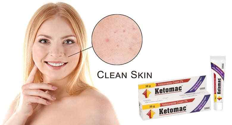 Ketoconazole Cream For Baby Face | Ketoconazole Cream