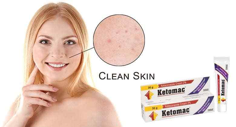 Treatment for Chronic Fungal Skin Infection Fungal