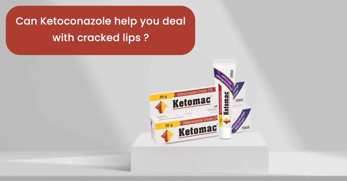 Can-Ketoconazole-help-you-deal-with-cracked-lips.jpg